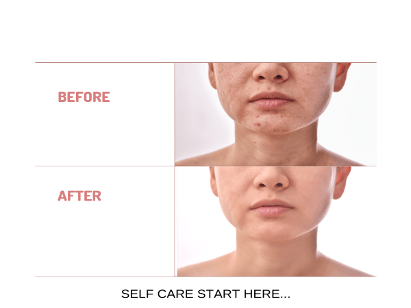 Organic Under Eye Youth Corrector and Neck Renewal Cream Duo - For